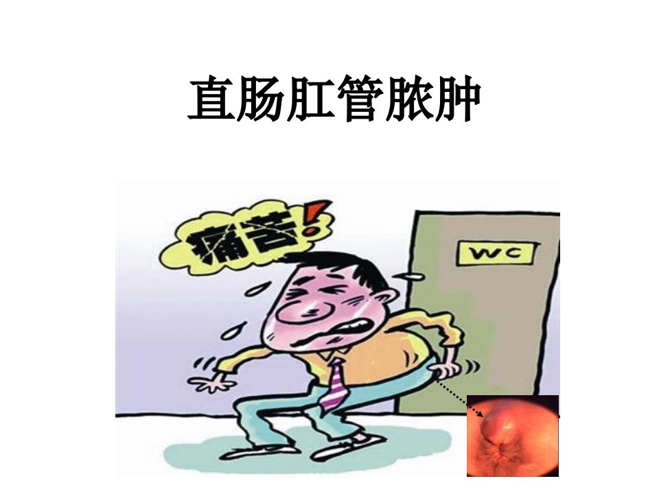 直肠肛管周围脓肿（ppt课件）