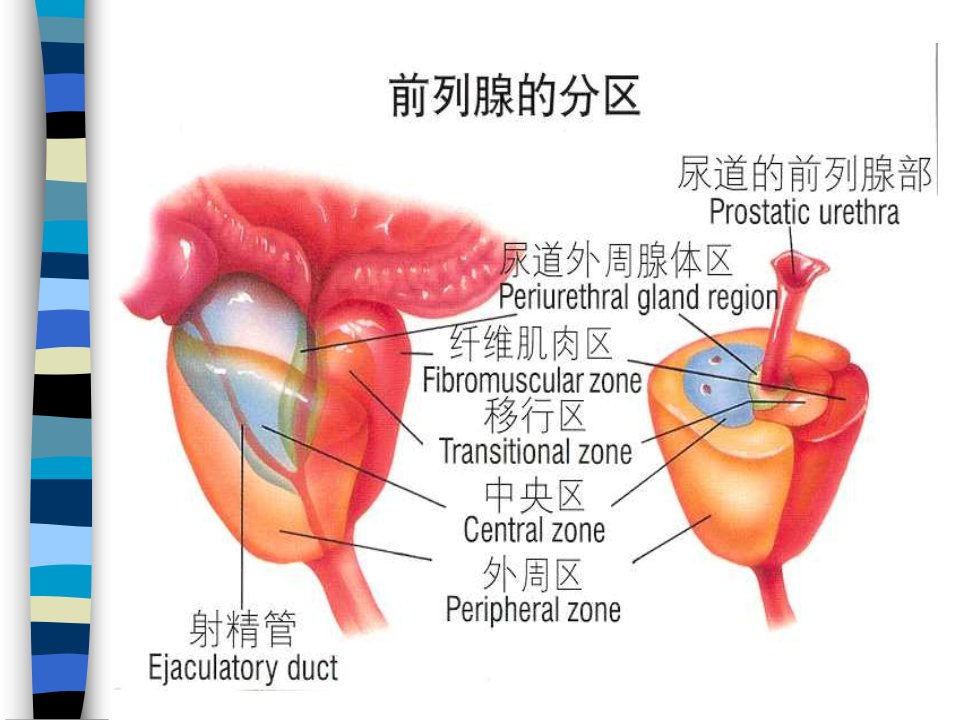 慢性前列腺炎和男性不育