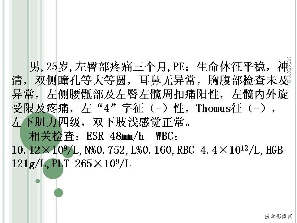 《髋骨小细胞淋巴瘤》PPT课件