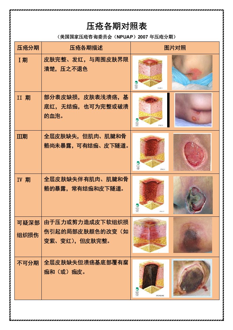 压疮各期对照表格(彩图)