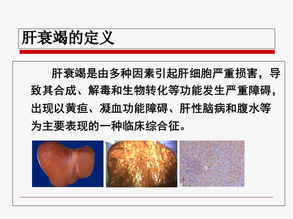 人工肝教学内容