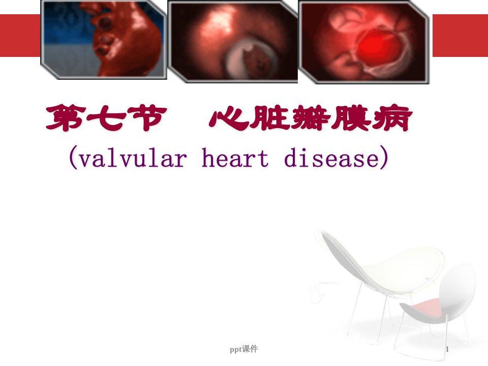 心脏瓣膜病-课件