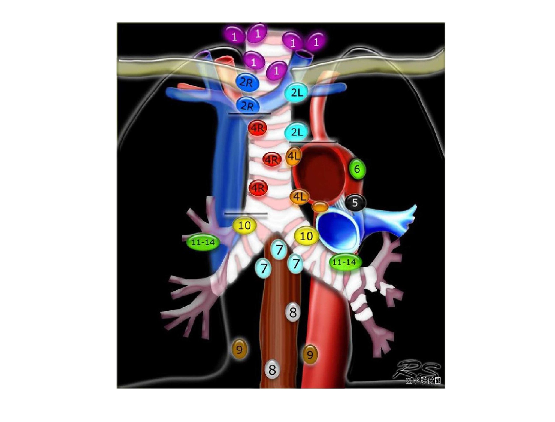 纵隔淋巴结分区