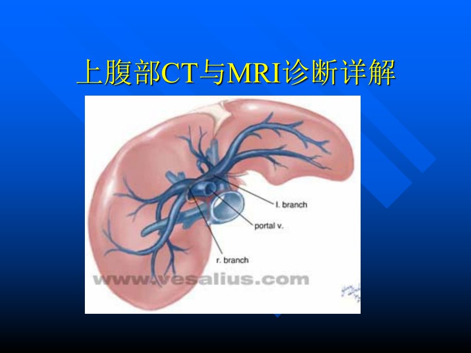 顾鑫上腹部CT与磁共振MRI教学PPT课件