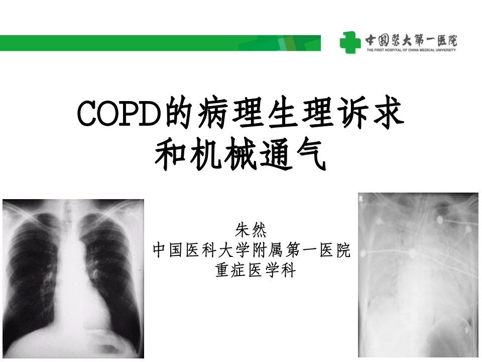 COPD的病理生理诉求