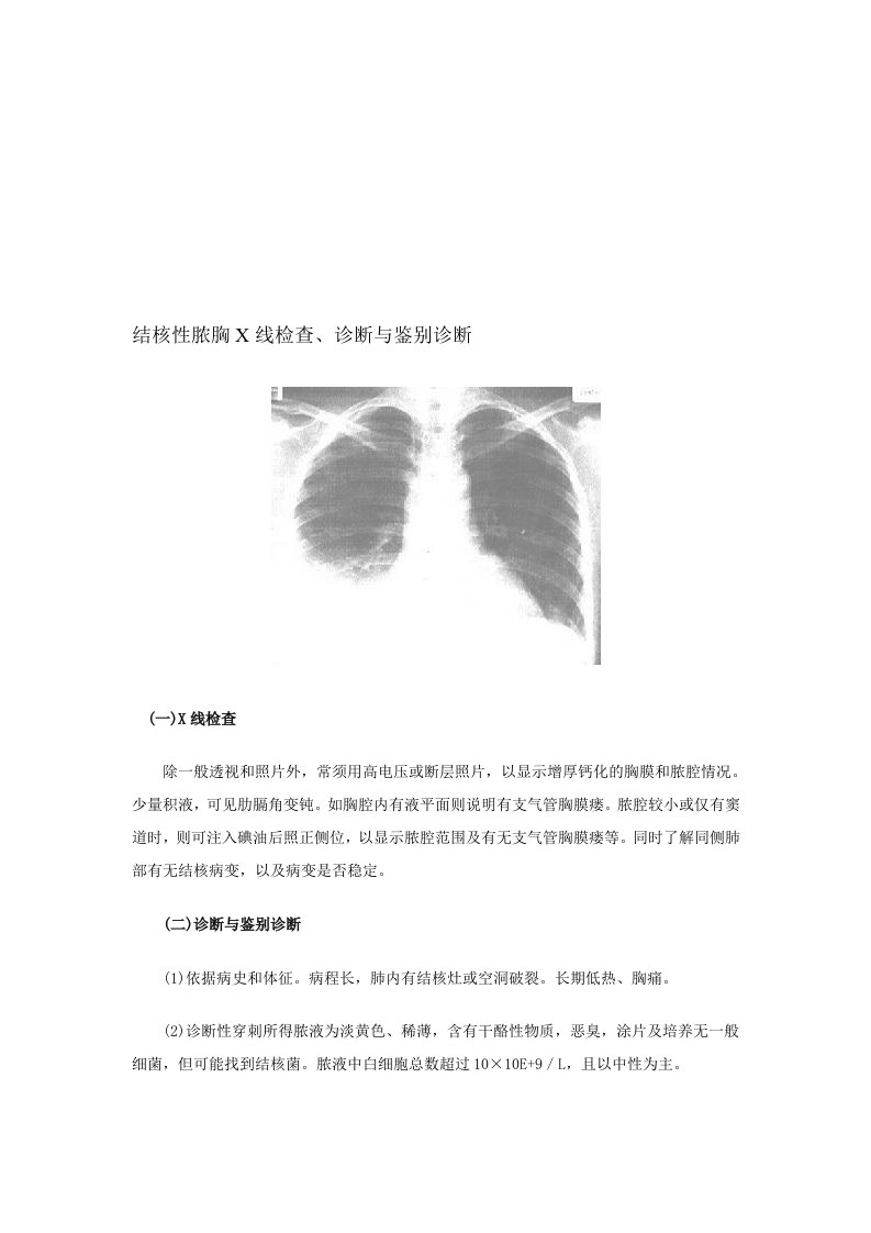 结核性脓胸X线检查、诊断与鉴别诊断