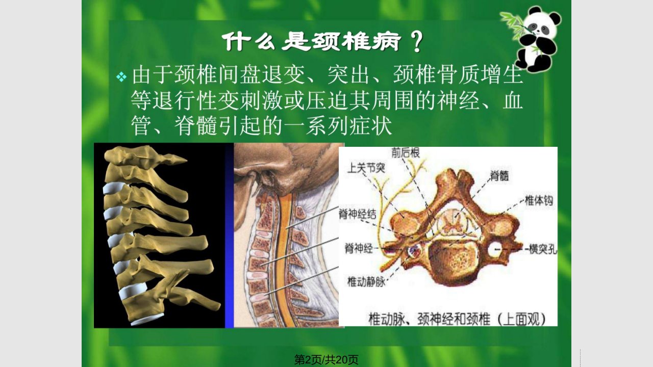 康复医学颈椎病康复