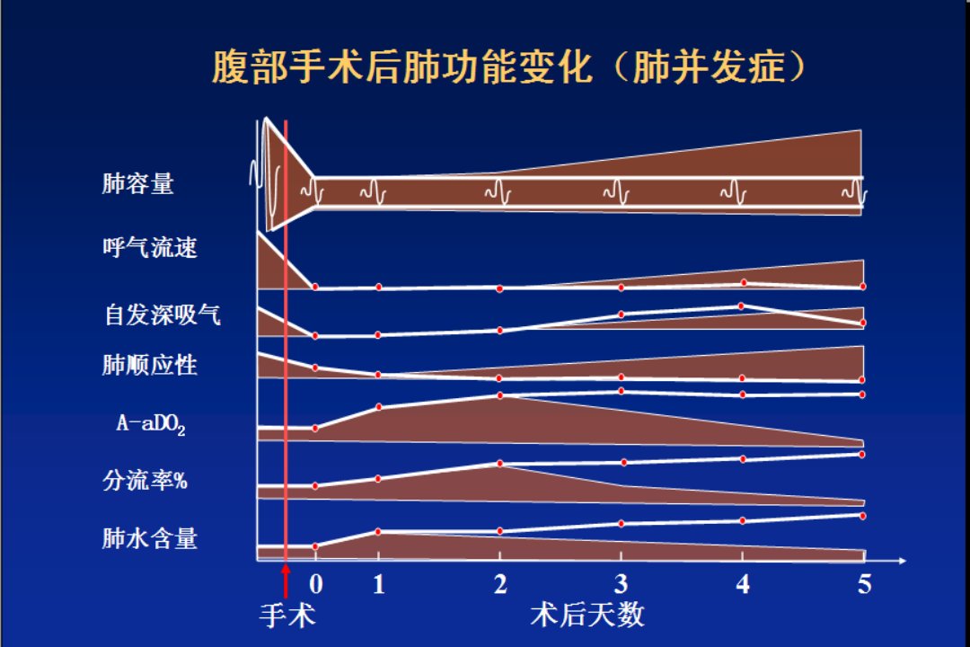 对HAP机制的深入认识与吸入性肺炎的防治