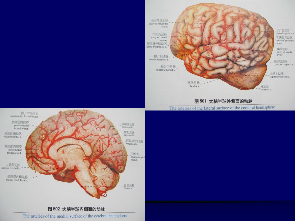 老年痴呆主题讲座讲义