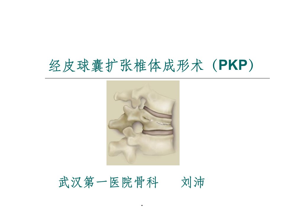 球囊扩张椎体成形pkp