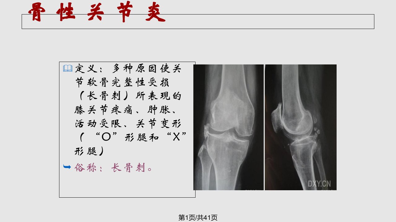 膝关节病健康教育PPT课件