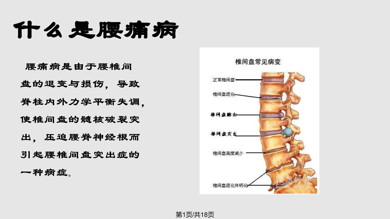 腰痛病健康教育PPT课件