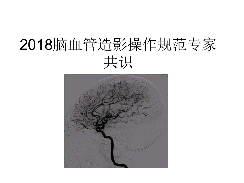 2018脑血管造影指南解读