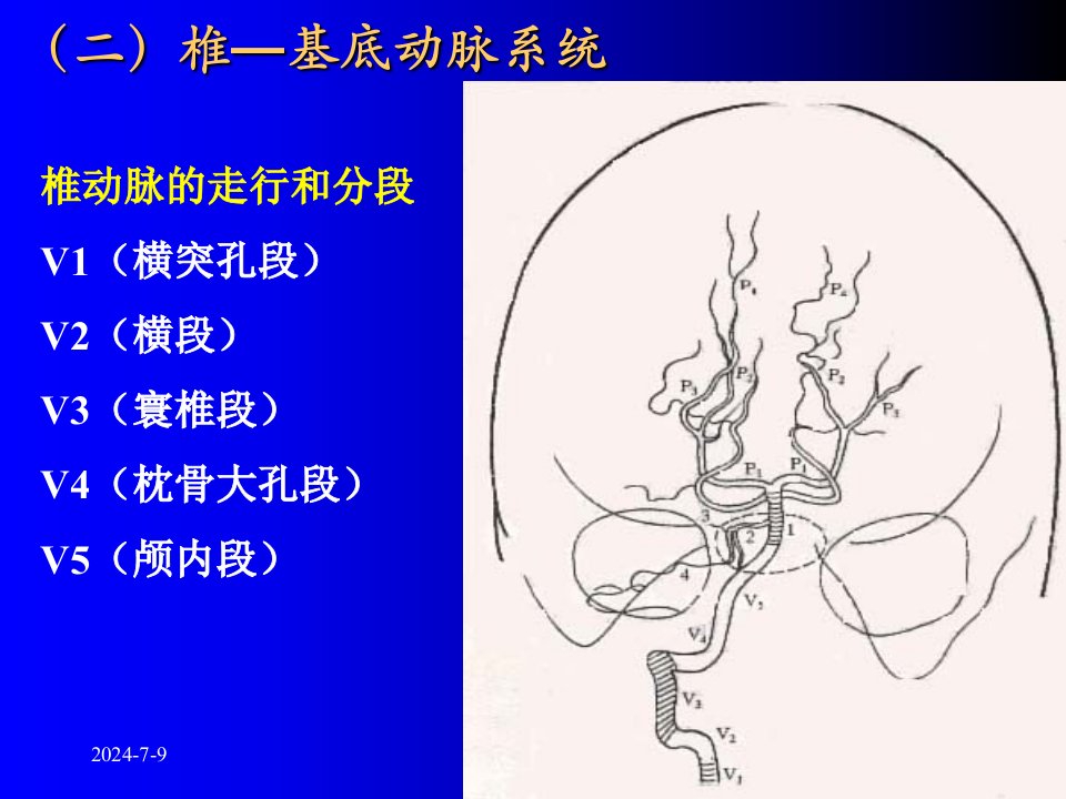 断层解剖脑血管