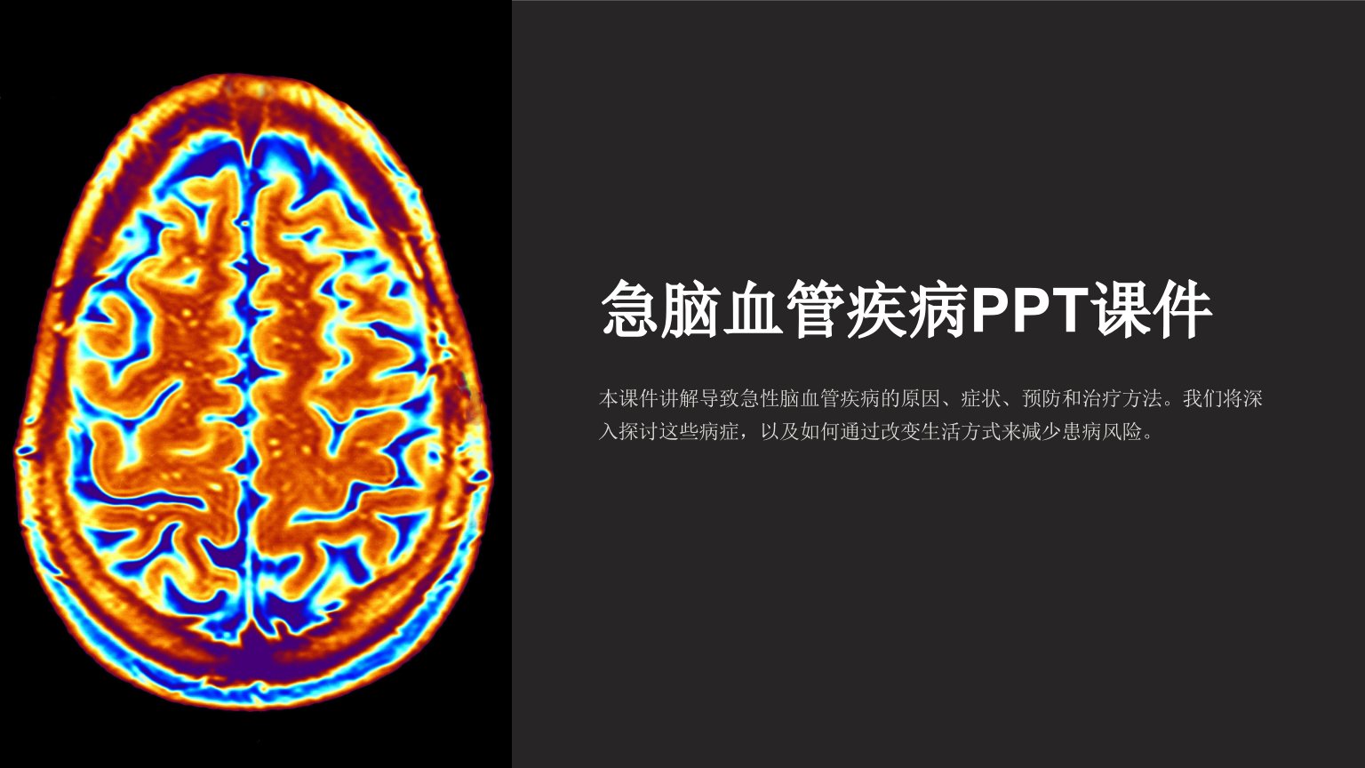 《急脑血管疾病》课件