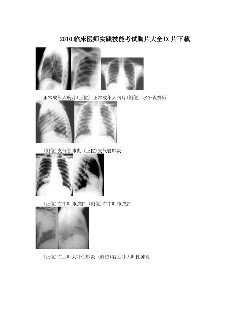 votAAA2010临床医师实践技能考试胸片大全!X片下载