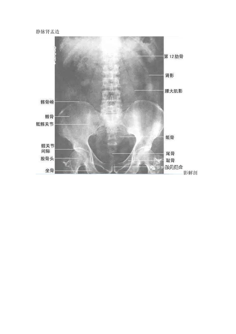 静脉肾盂造影检查技术