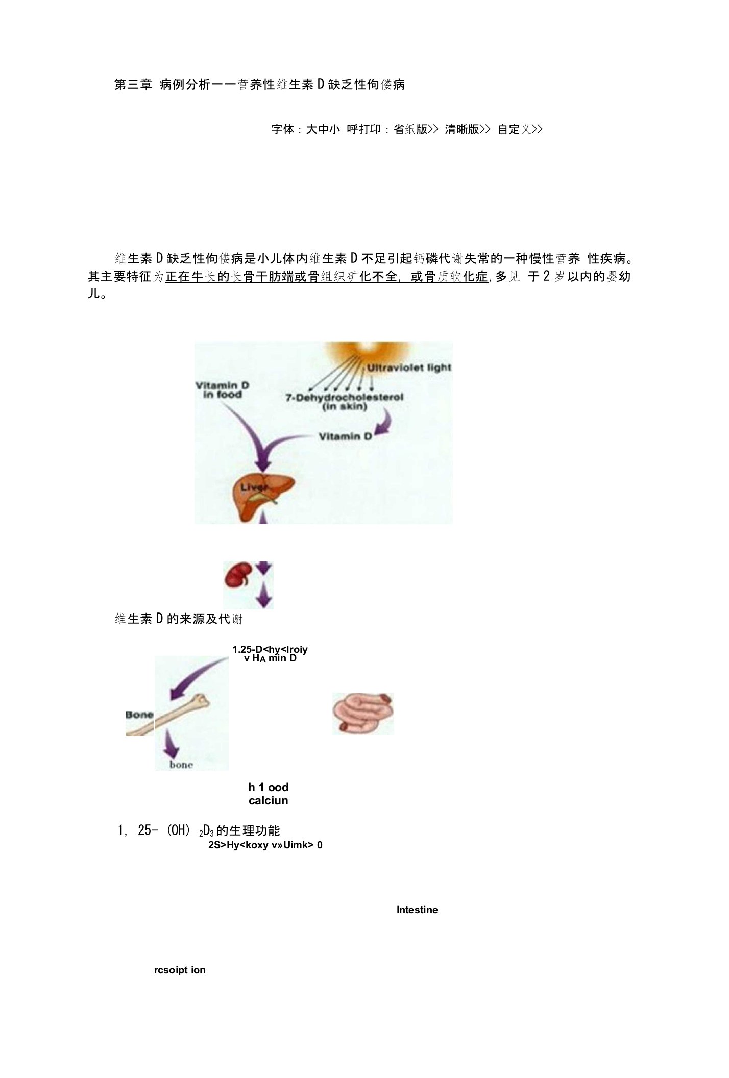 病例分析——营养性维生素D缺乏性佝偻病