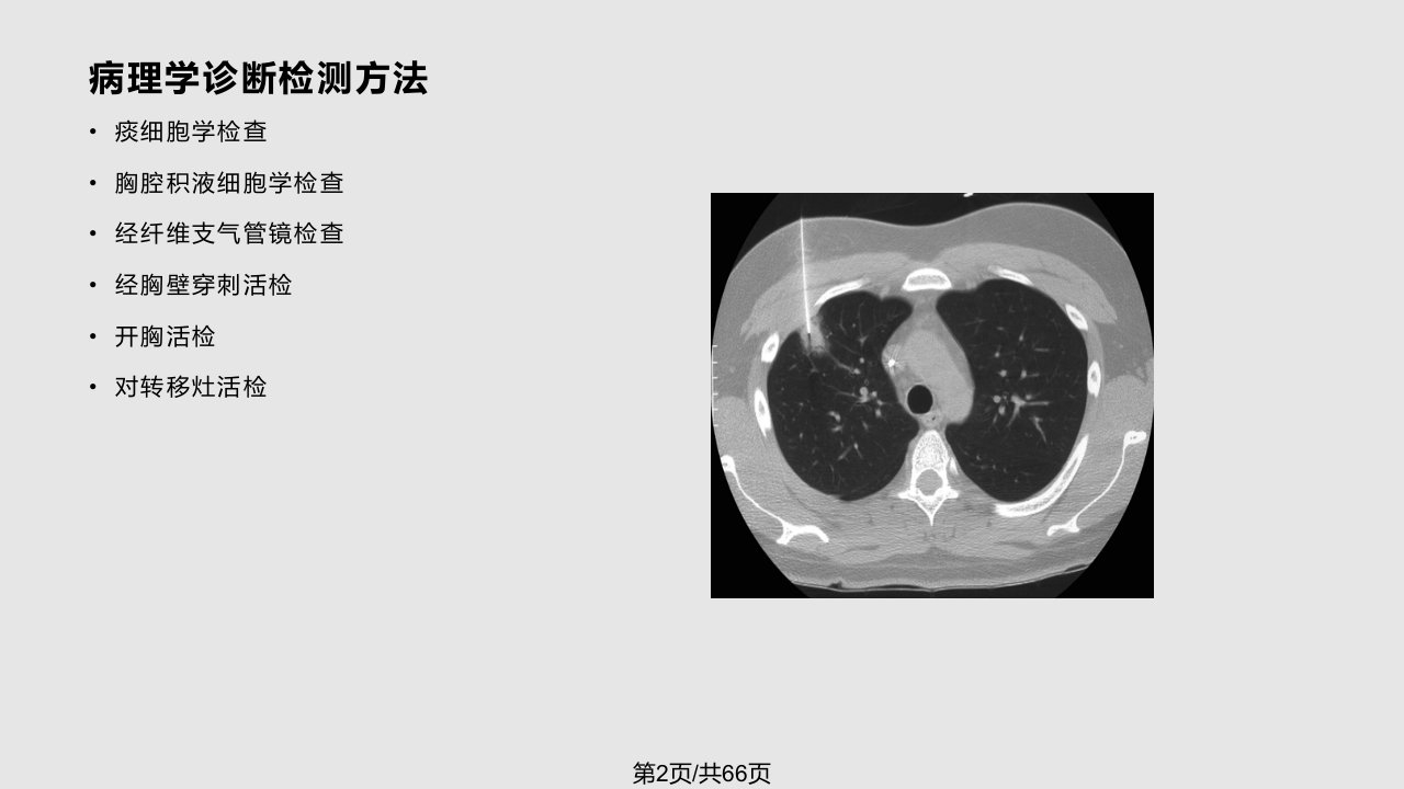 肺癌患者围术期处理新进展讲诉