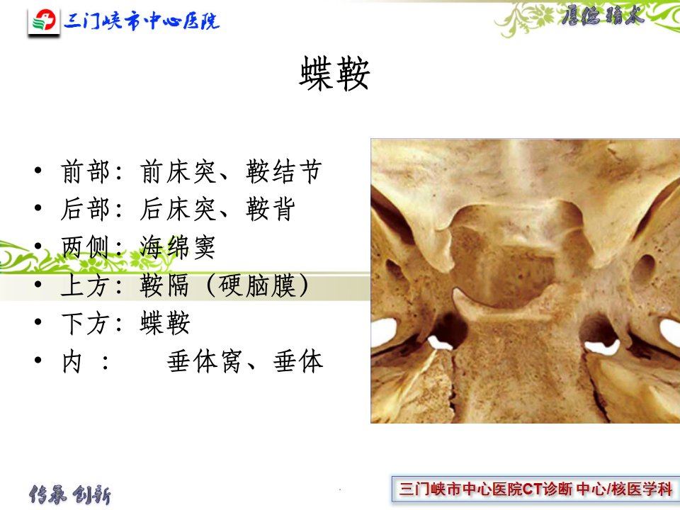 垂体解剖及垂体瘤ppt课件