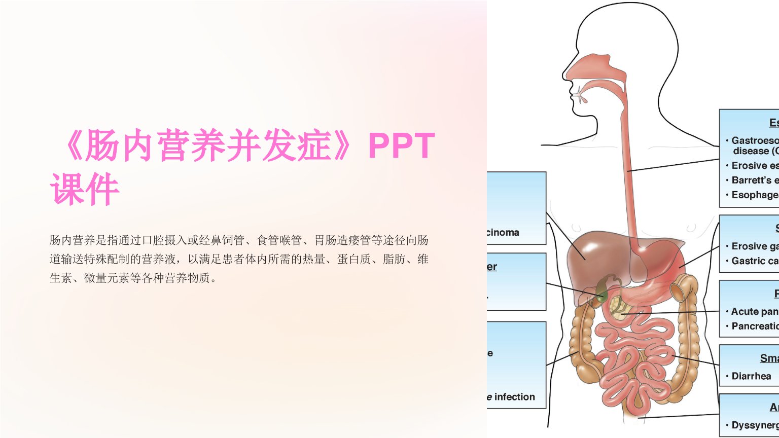 《肠内营养并发症》课件