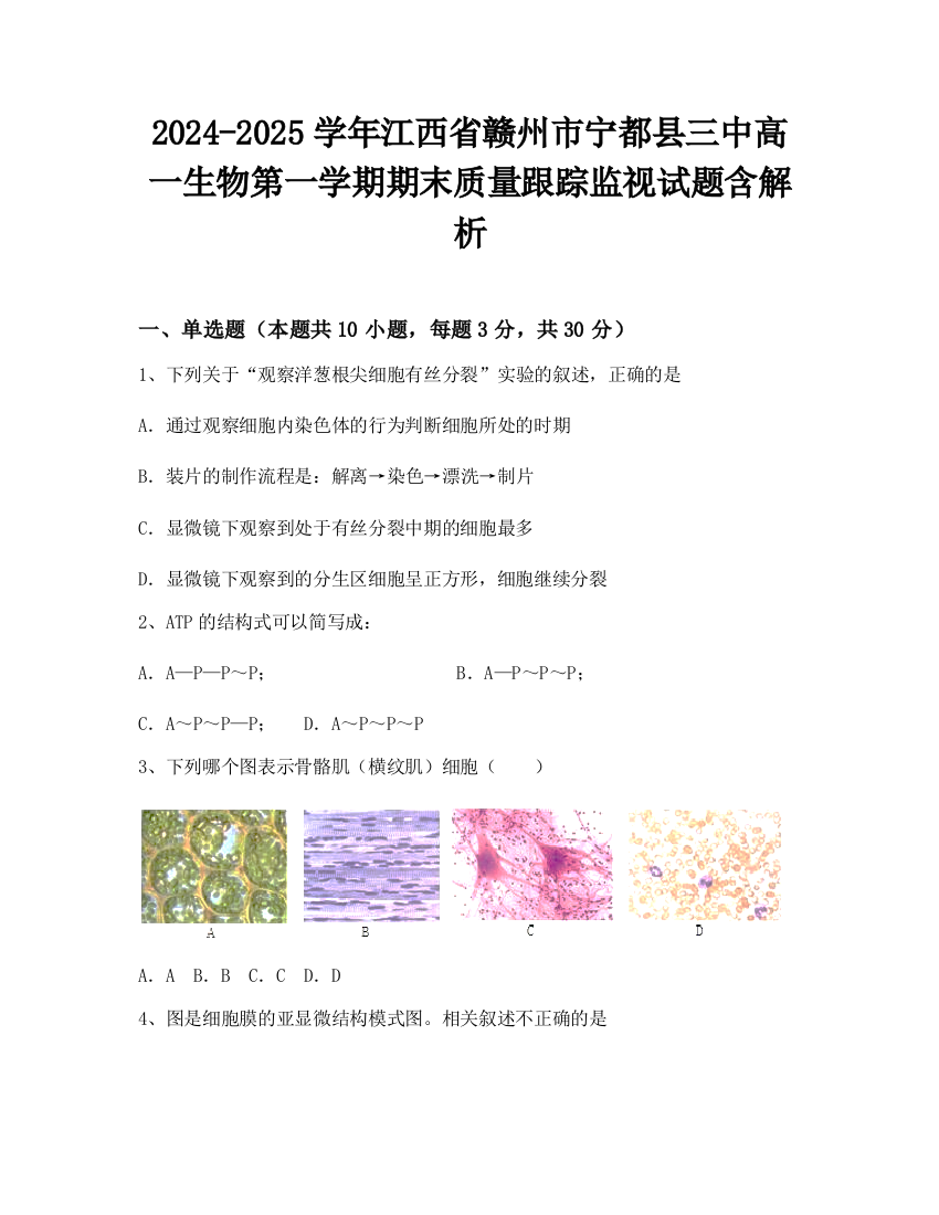 2024-2025学年江西省赣州市宁都县三中高一生物第一学期期末质量跟踪监视试题含解析