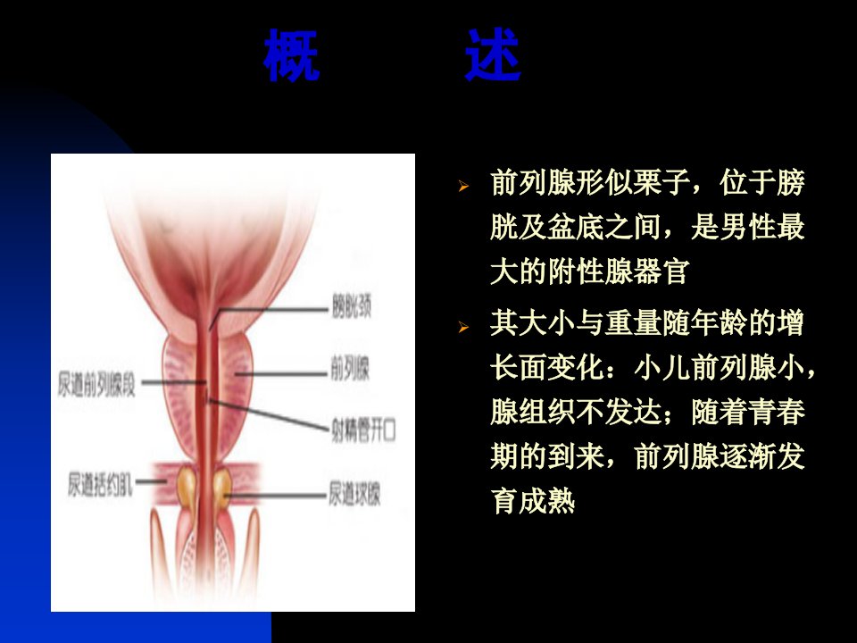 医学专题前列腺炎