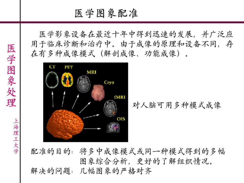 《医学图象处理》PPT课件