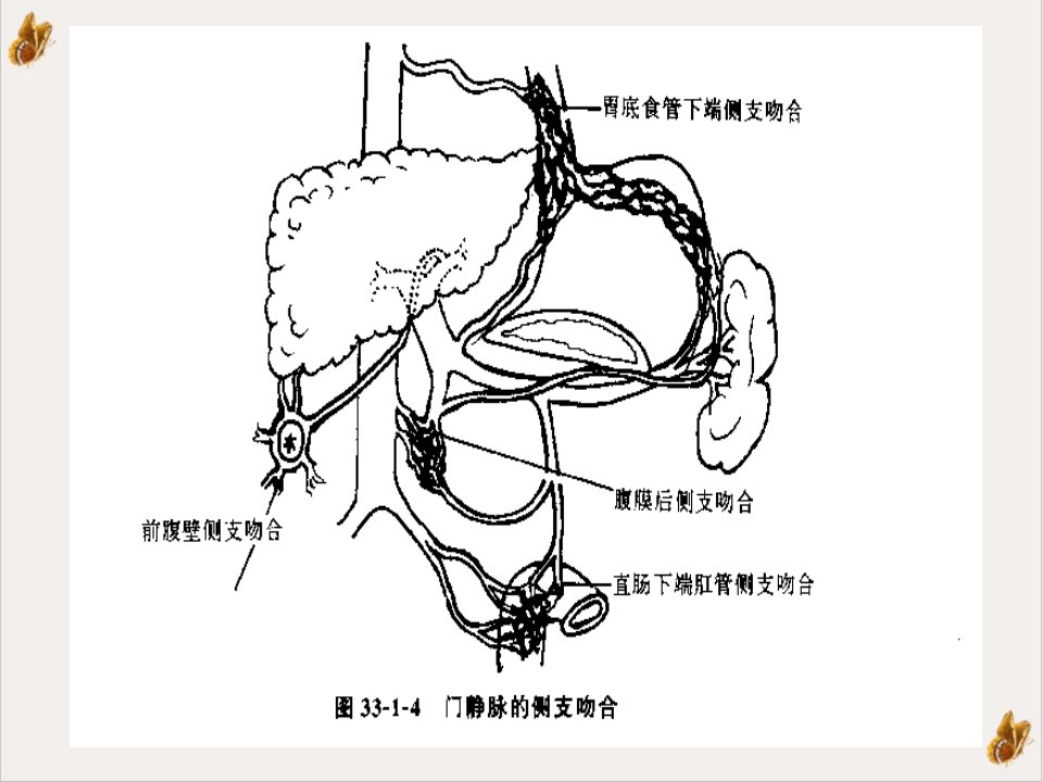 门静脉高压症的发病机制及治疗现状ppt课件