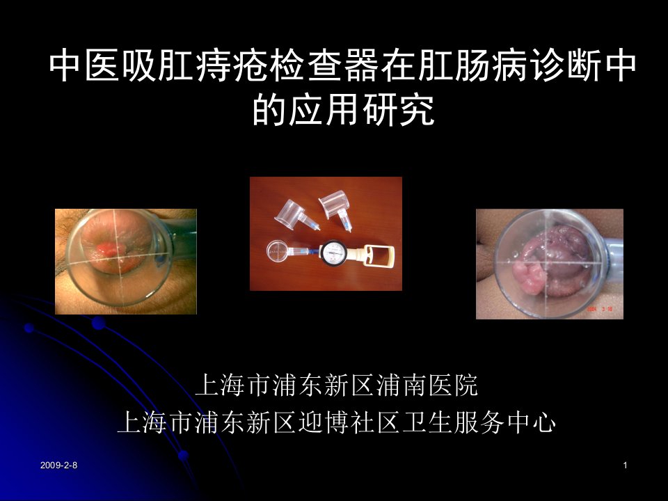 中医吸肛痔疮检查器在肛肠病诊断中的应用研究-优势中医技术01dy