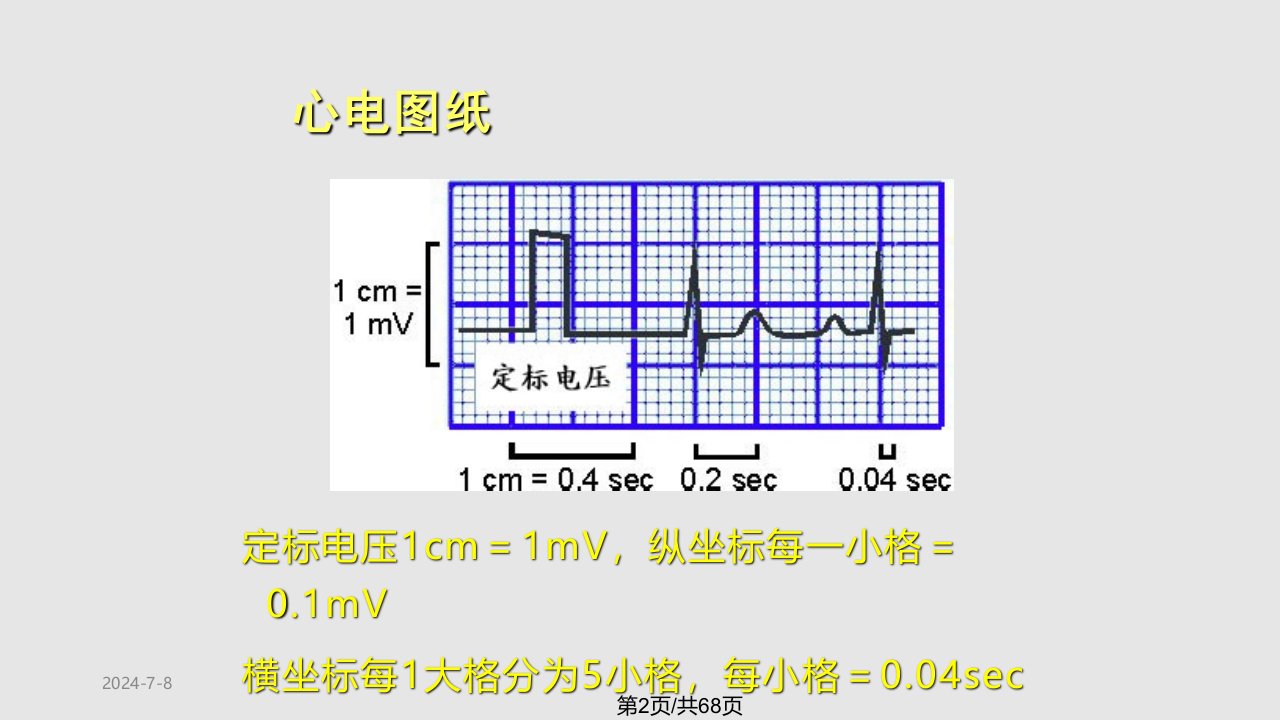 急性冠状动脉综合征急诊处理