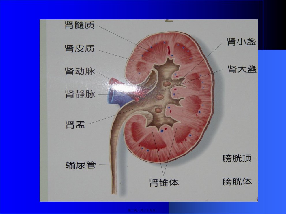 医学专题泌尿系统梗阻概论