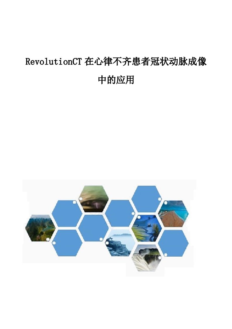 RevolutionCT在心律不齐患者冠状动脉成像中的应用