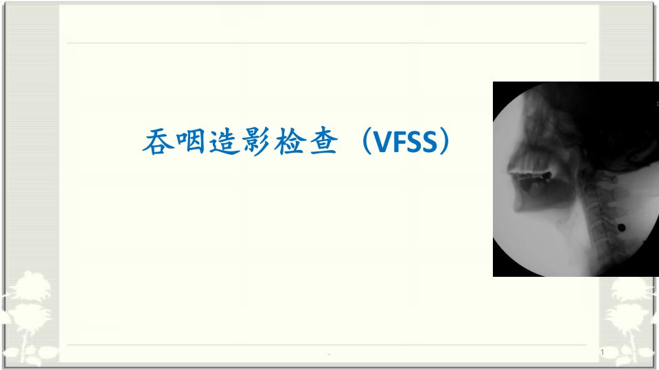 吞咽造影检查VFSS医学课件