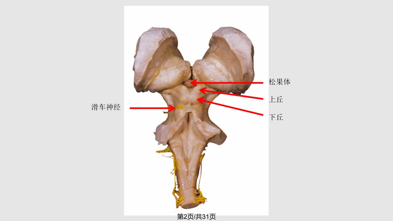 神经系统标本训练题