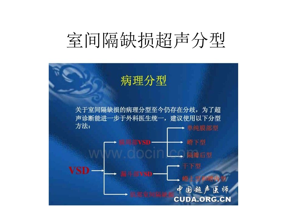 室间隔缺损超声分型ppt课件