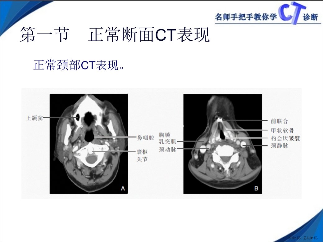 名师手把手教你学CT第四章颈部