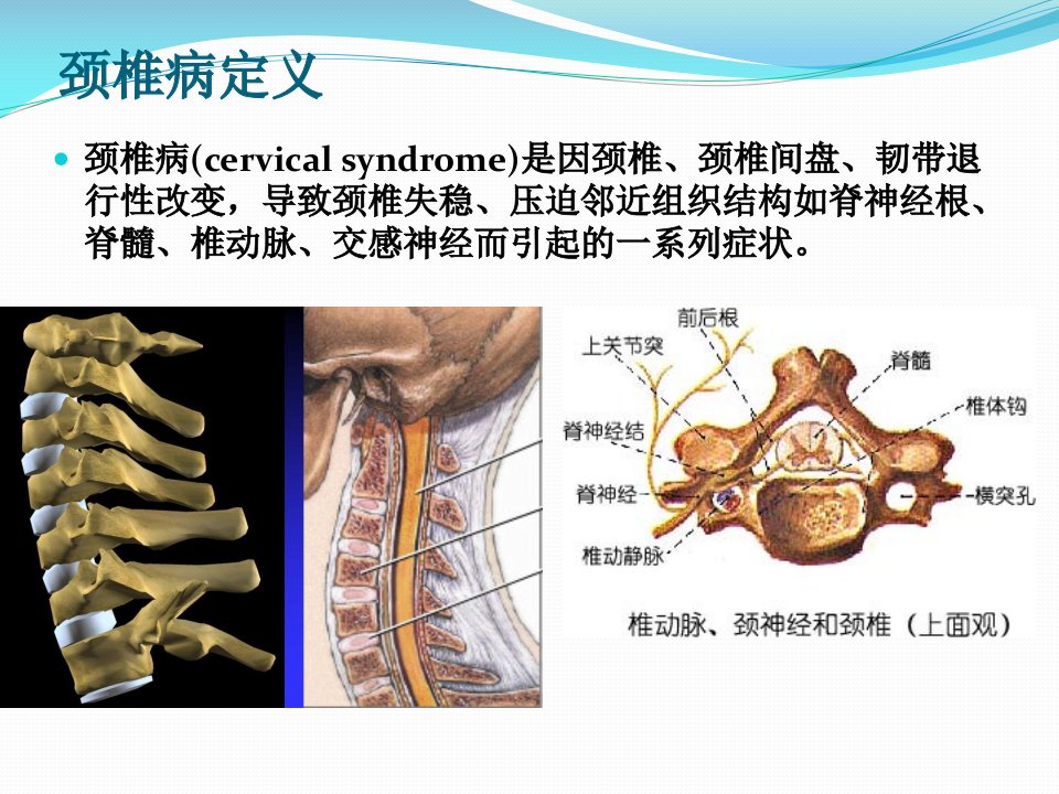 颈椎病的治疗与康复解答ppt课件