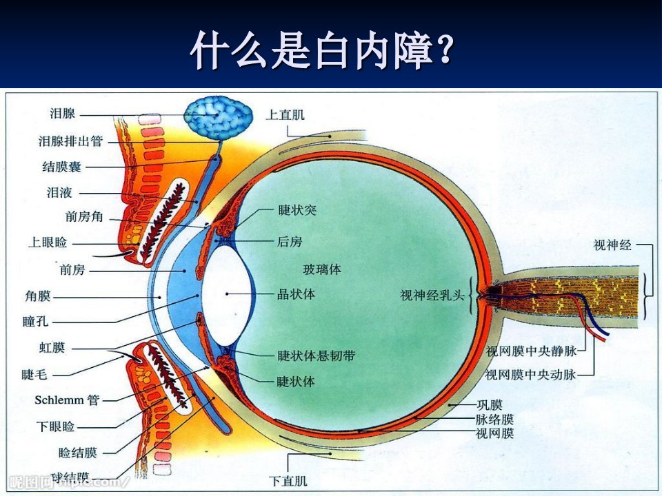 白内障宣教ppt课件