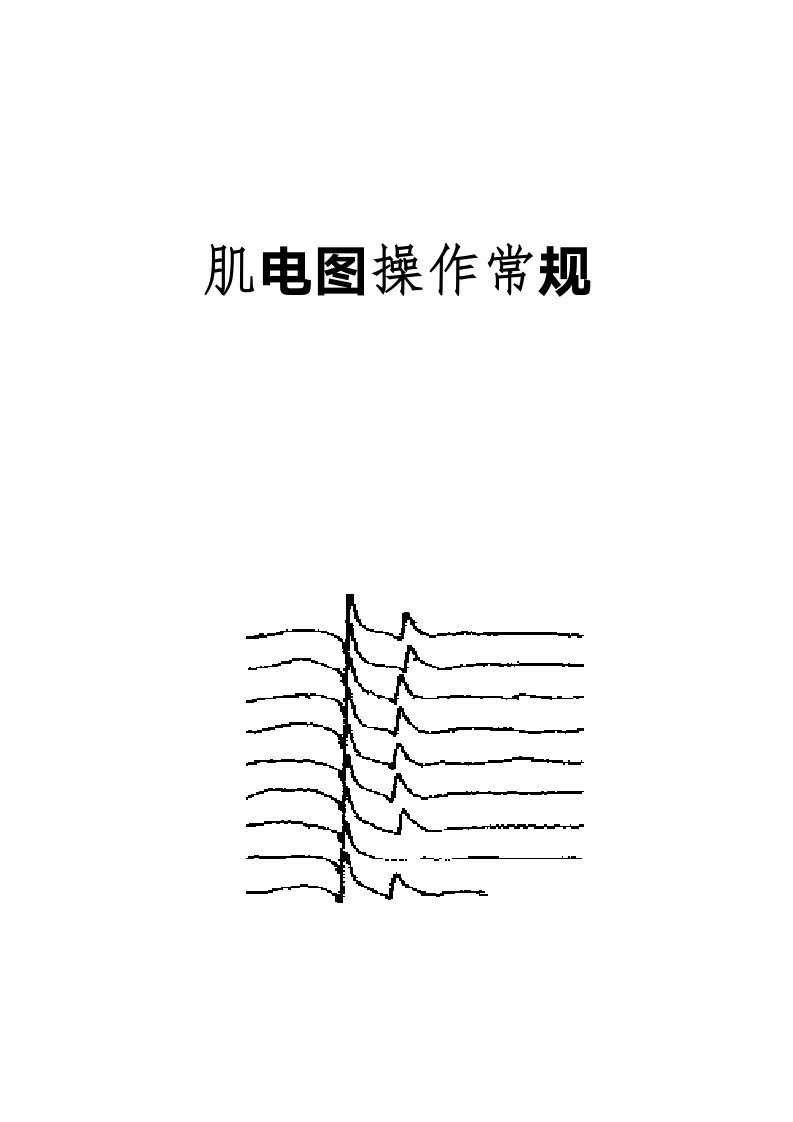 肌电图操作常规摘要