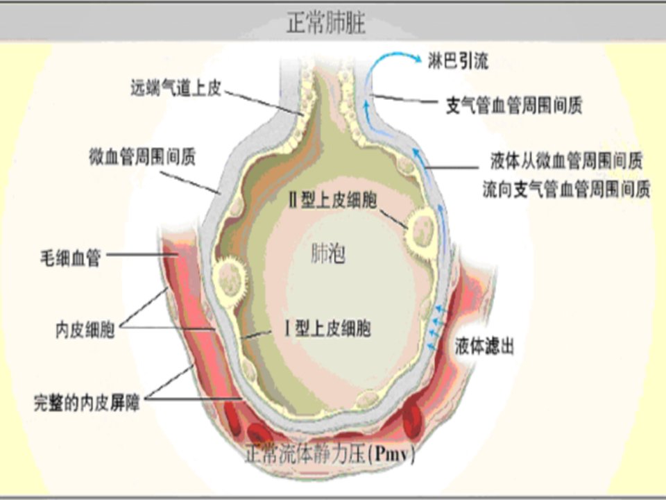 急性肺水肿三系讲课