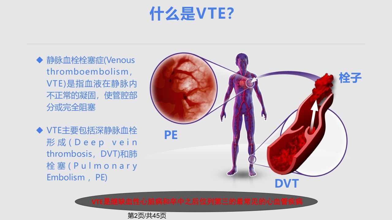 静脉血栓栓塞症