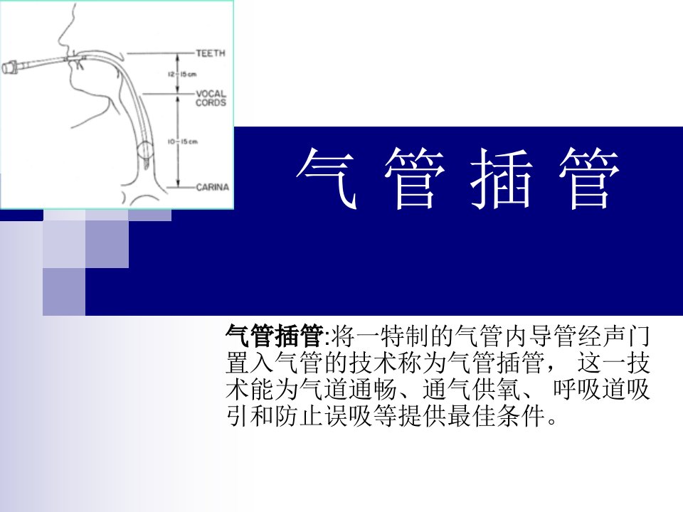 气管插管课件