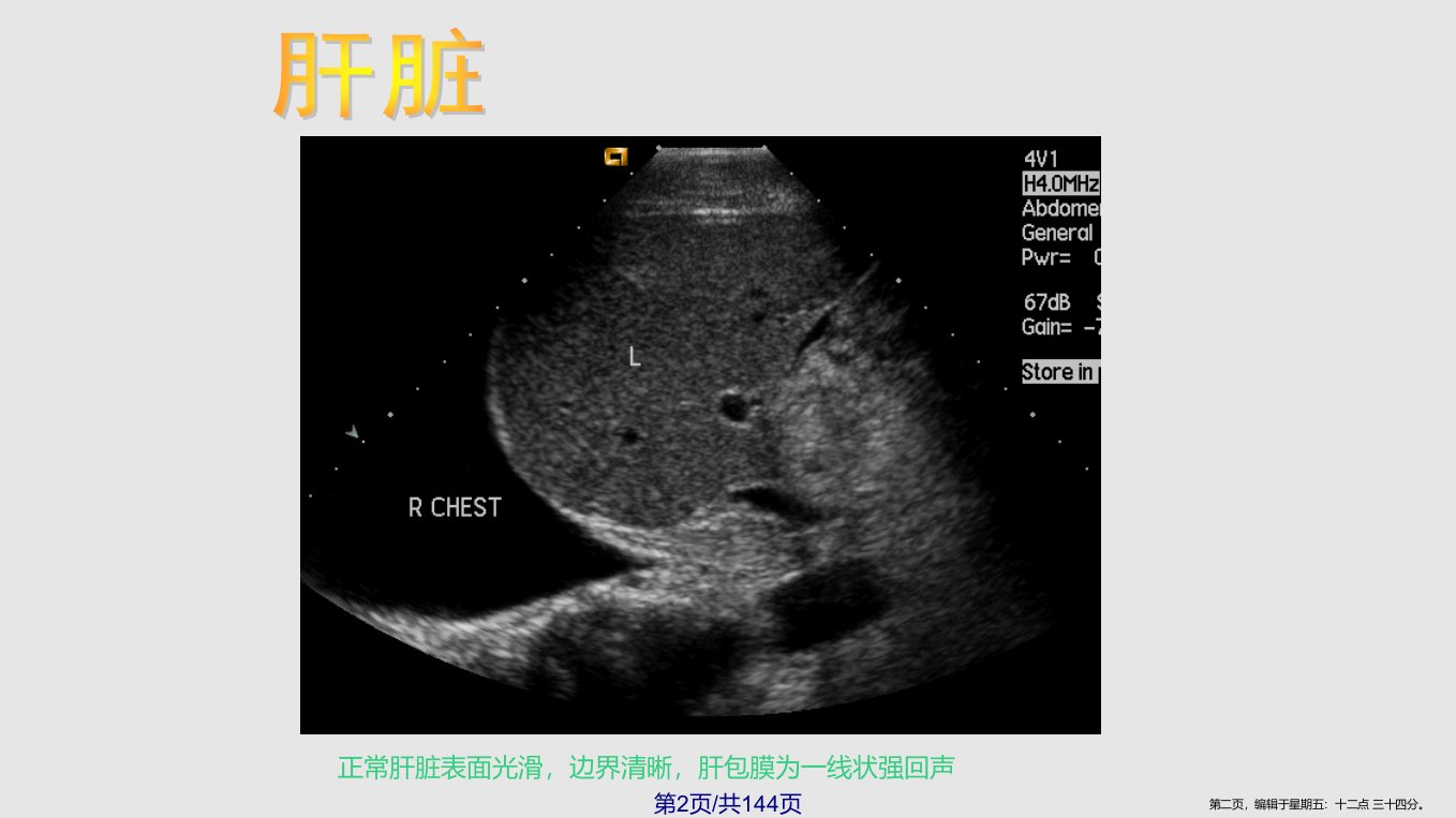 B超影像图谱学习