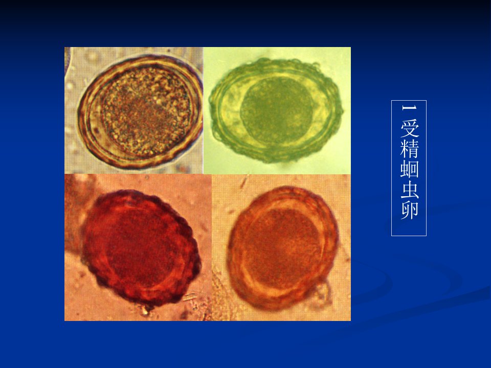 人体寄生虫学标本复习课件