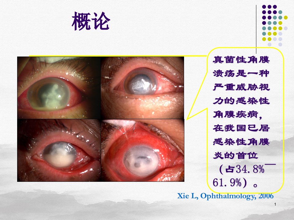 真菌性角膜炎ppt课件