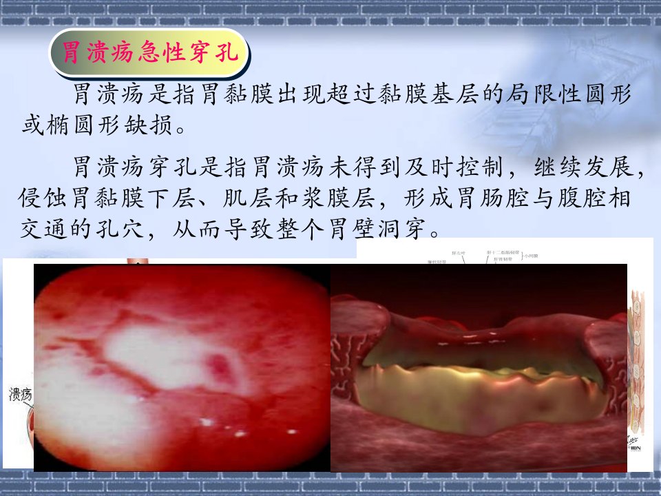 局解病例分析PPT课件