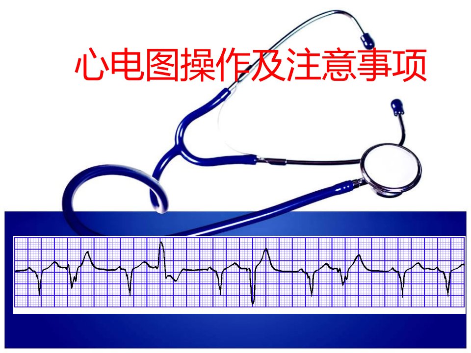 心电图检查操作及注意事项幻灯片