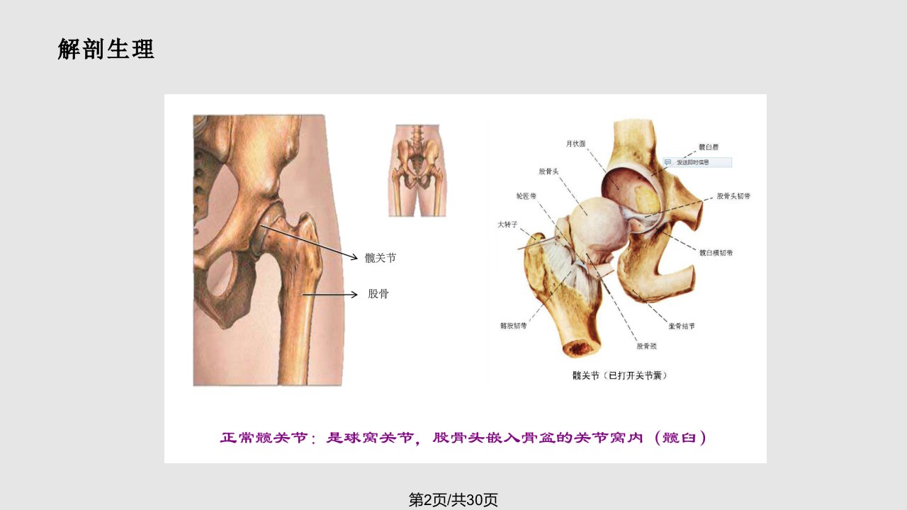 股骨头置换术后护理查房