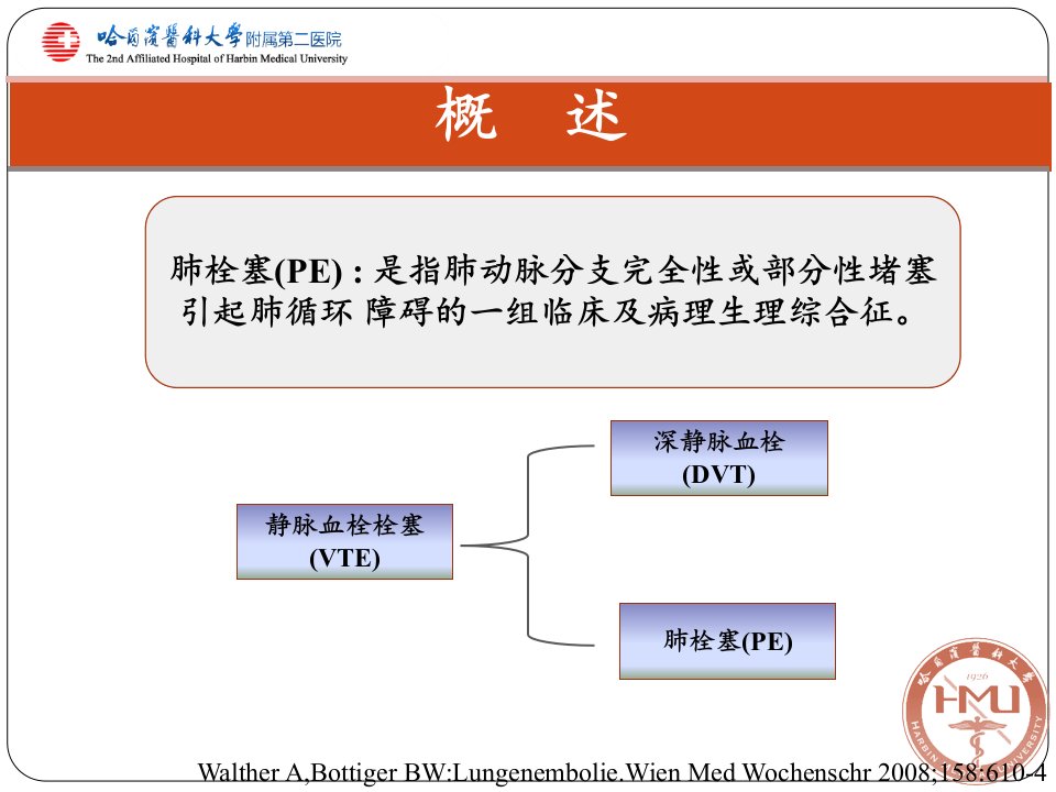 急性肺栓塞的诊治误区结合ESC